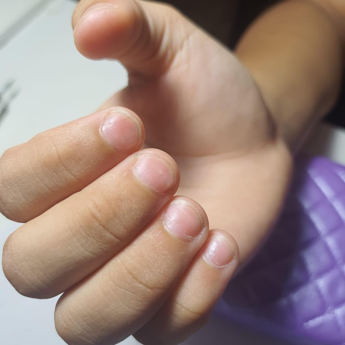 Remoção de soft gel + nova aplicação