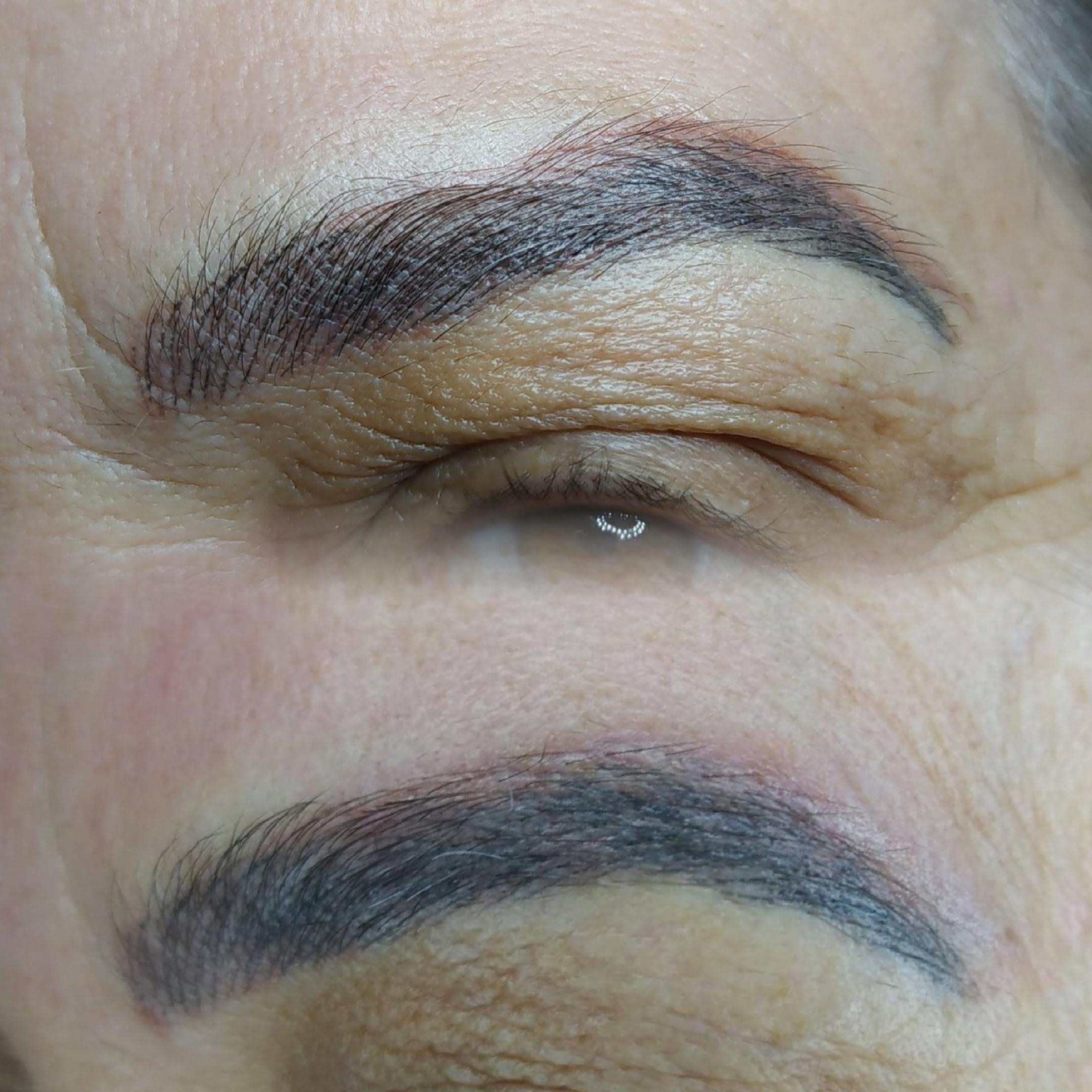 Despigmentação química