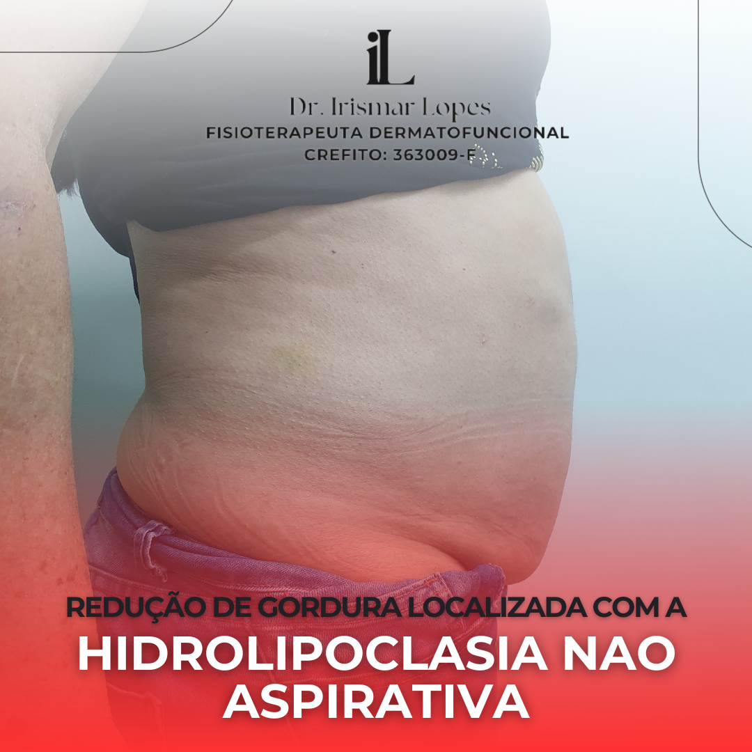 Pacote - 5 Hidrolipo + 2 Inibidor de apetite + 2 Corrente Russa