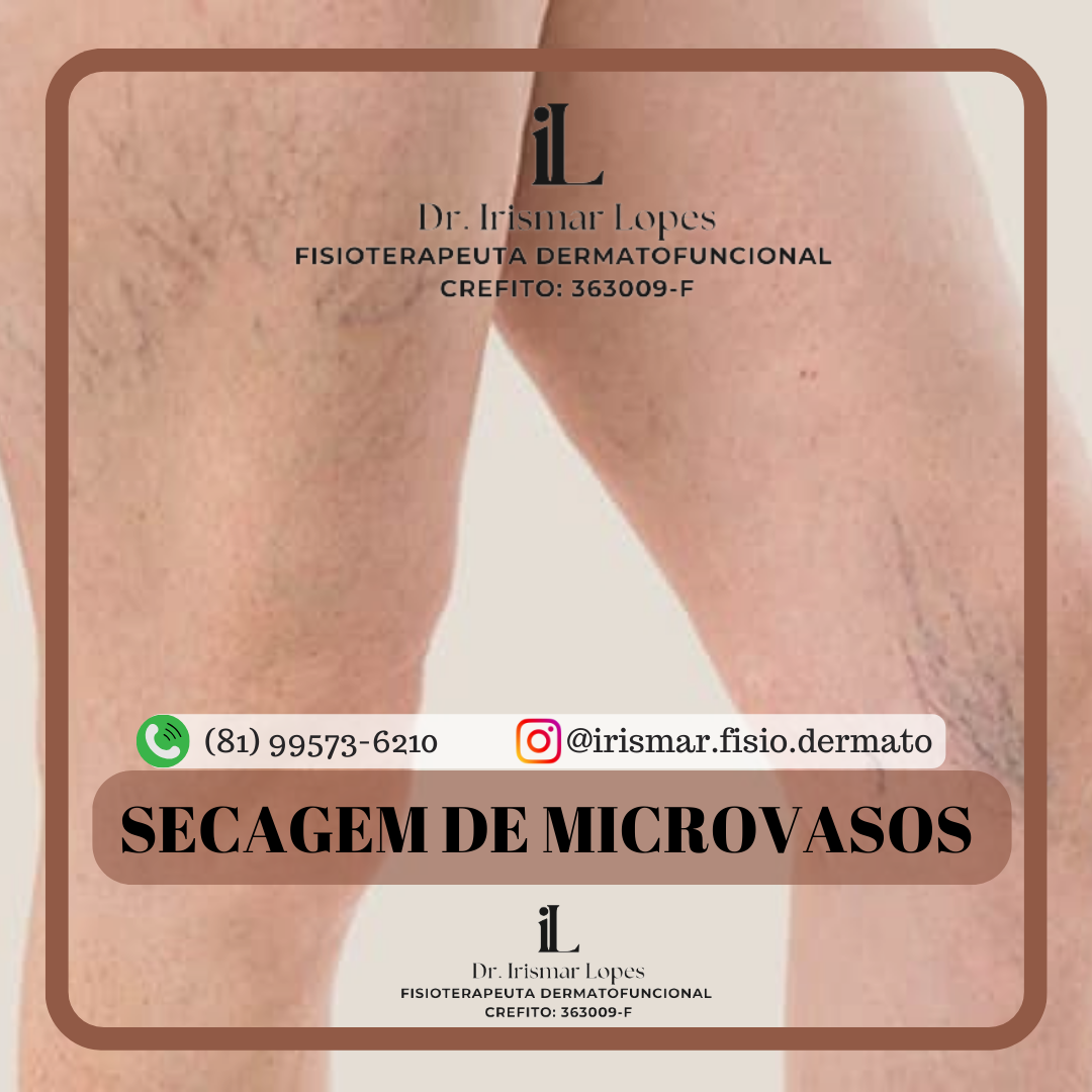 PEIM- Secagem de microvasos