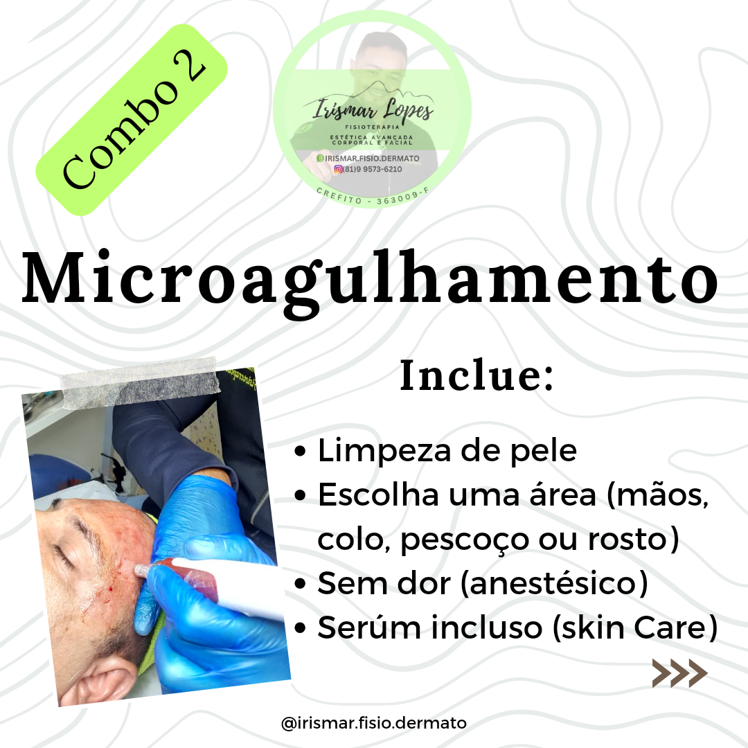 Microagulhamento Facial