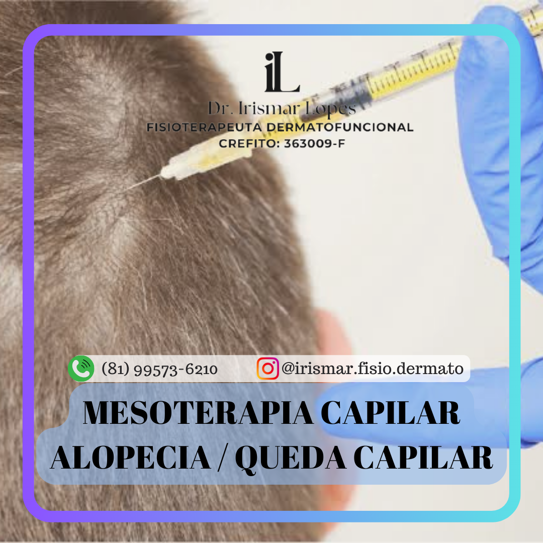 Tratamento Capilar - Alopecia