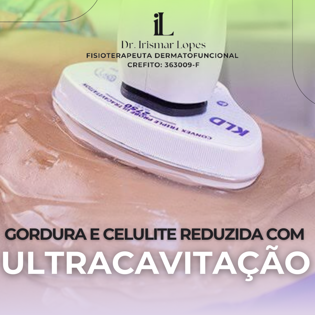 Ultracavitação - Por área