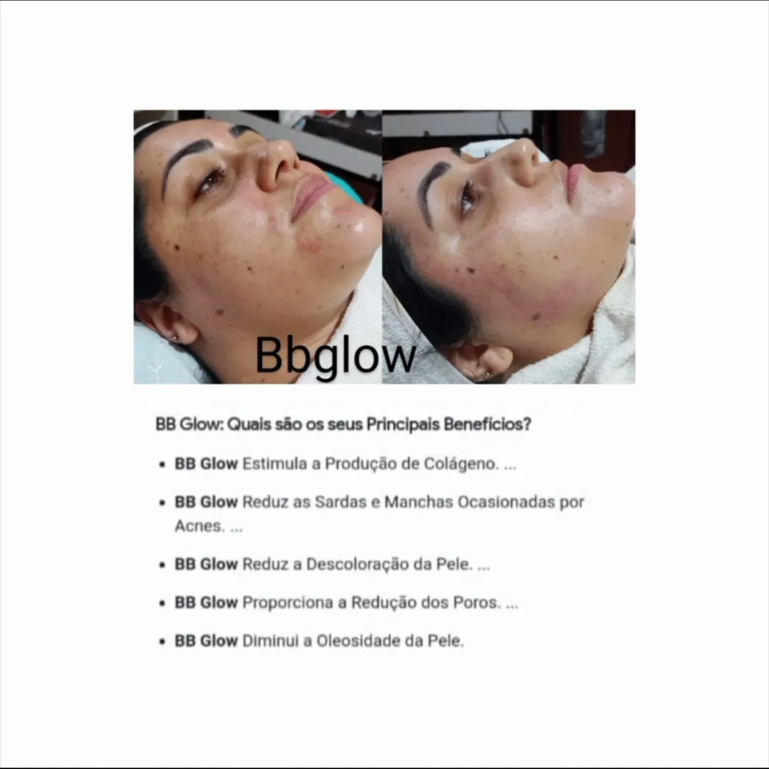 BB GLOW micro agulhamento facial com cor