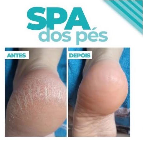 Spa dos pés