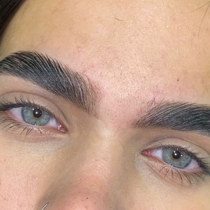 brow laminition