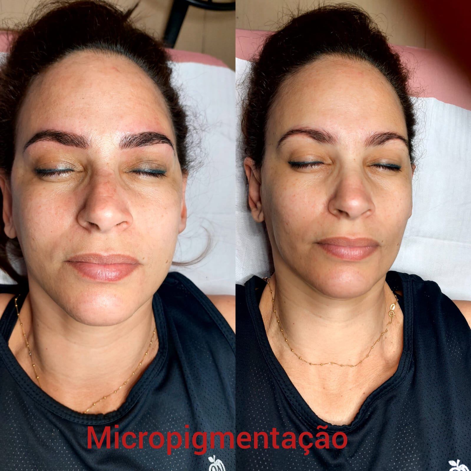 Micropigmentação