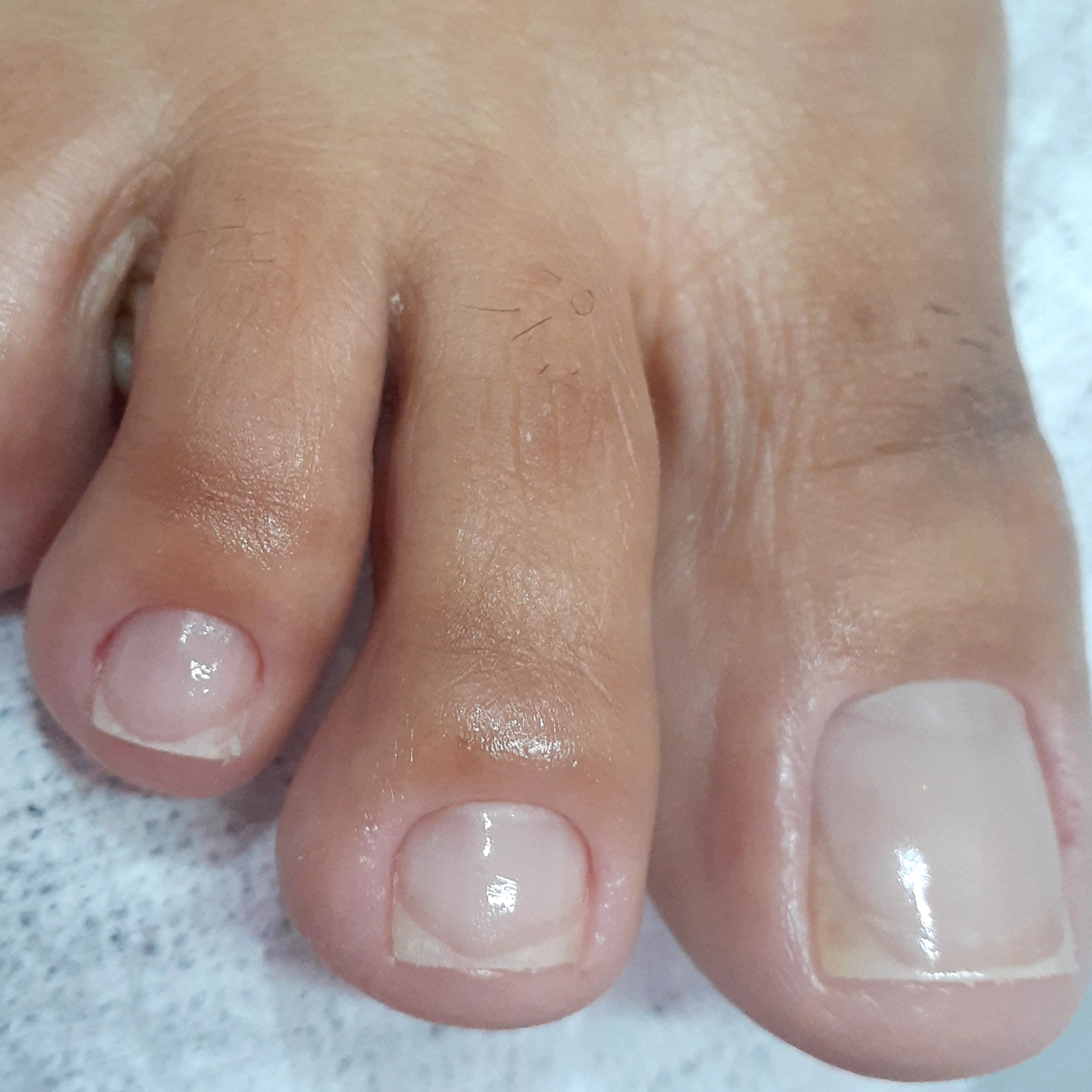 CUTICULAGEM ( PÉ OU MÃO)