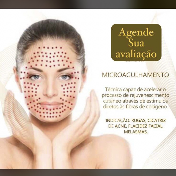 microagulhamento facial