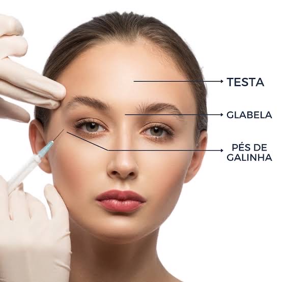 Botox testa