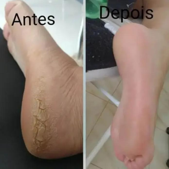 Spa dos pés com pedicure: (cutícula e esmaltação simples)