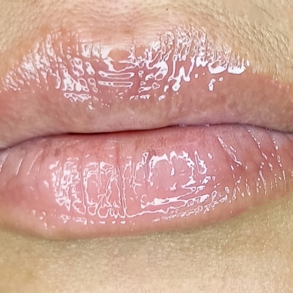 esfoliação labial