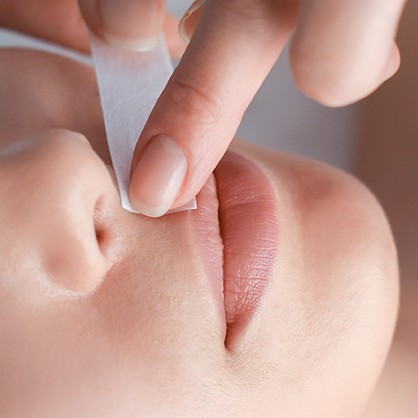 Depilação de buço