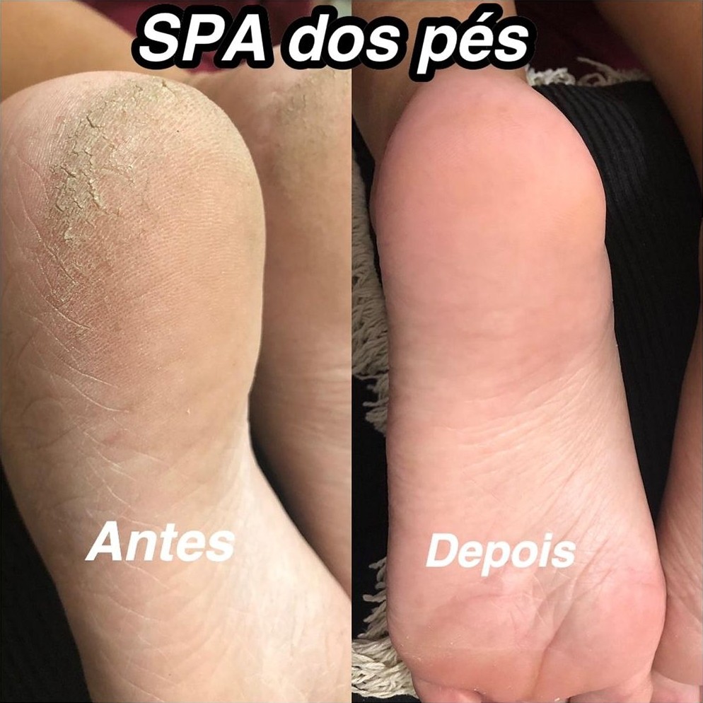 SPA dos pés cm esmaltação