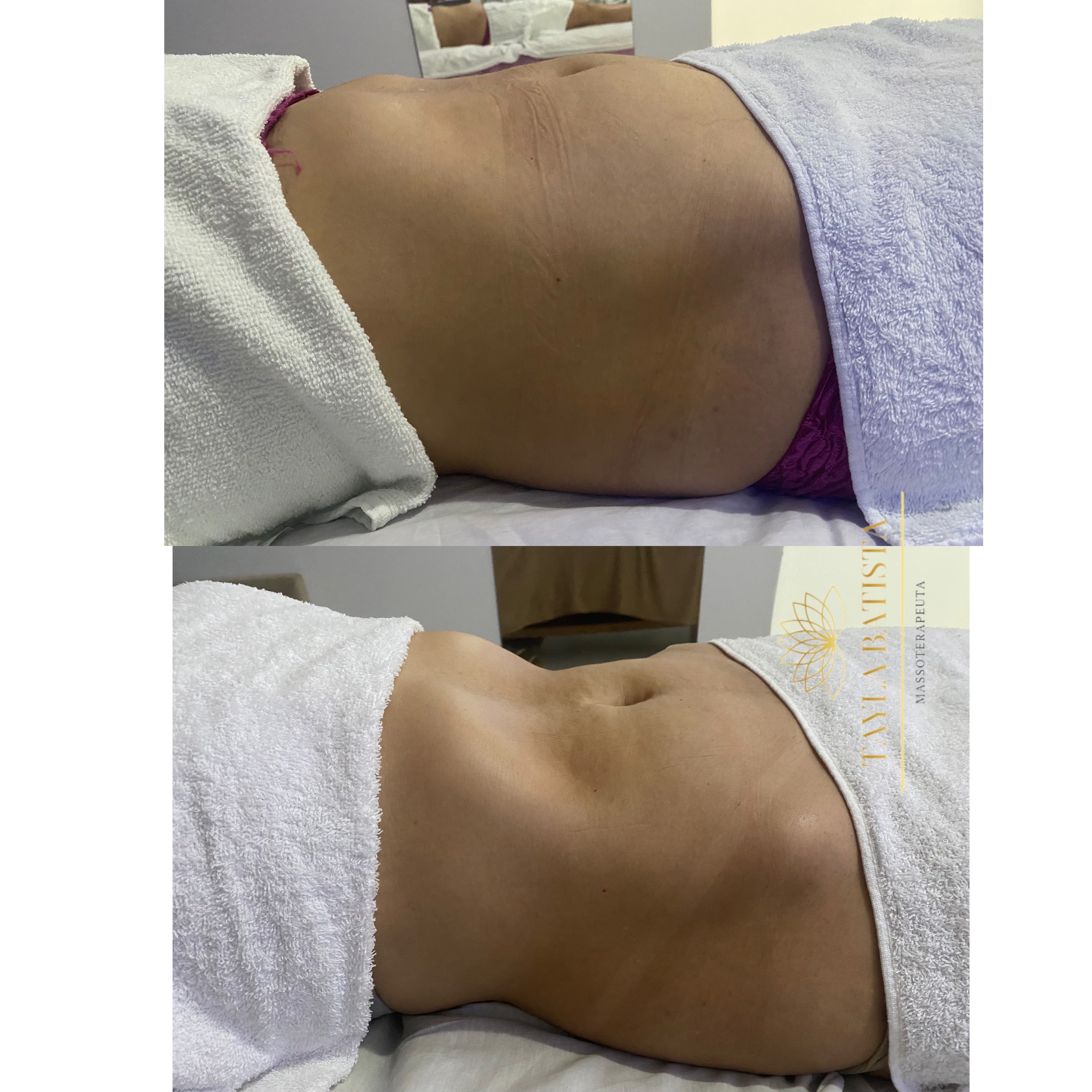 Massagem modeladora