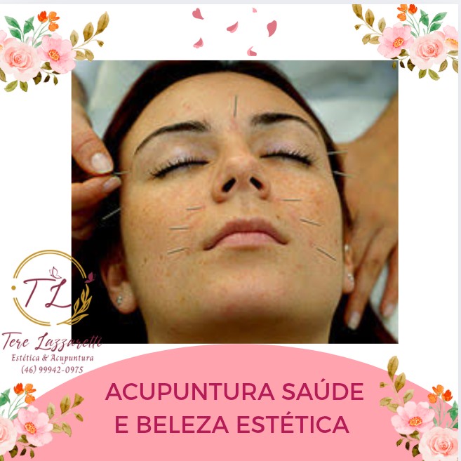 ACUPUNTURA SAÚDE E BELEZA ESTÉTICA, (FEITO NA FACE) NOS PONTOS ENERGÉTICOS DA FACE!