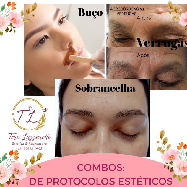 COMBOS, SOBRANCELHA, BUÇO, VERRUGAS