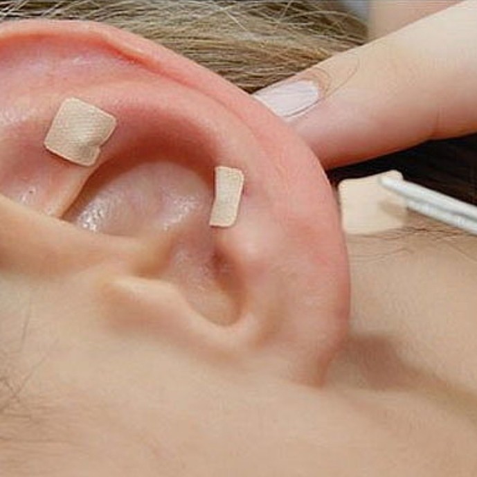 Auriculoterapia Sessão com anamnese