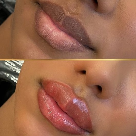 Neutralização labial