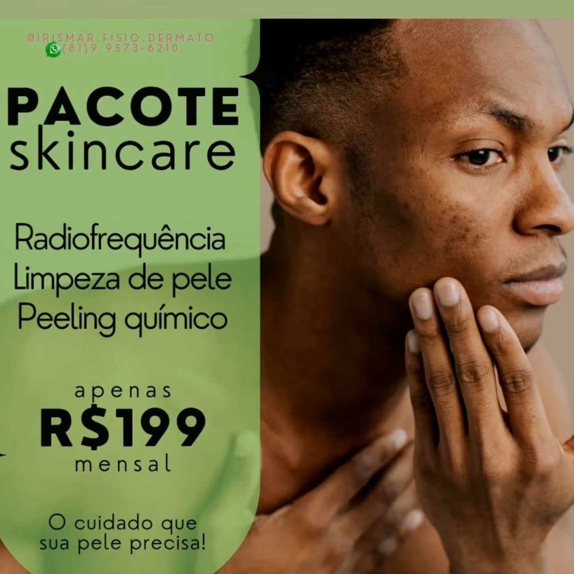 Skincare= Limpeza Profunda + Radiof + Peeling quimico