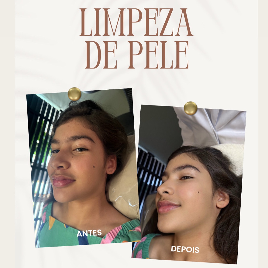 limpeza de pele