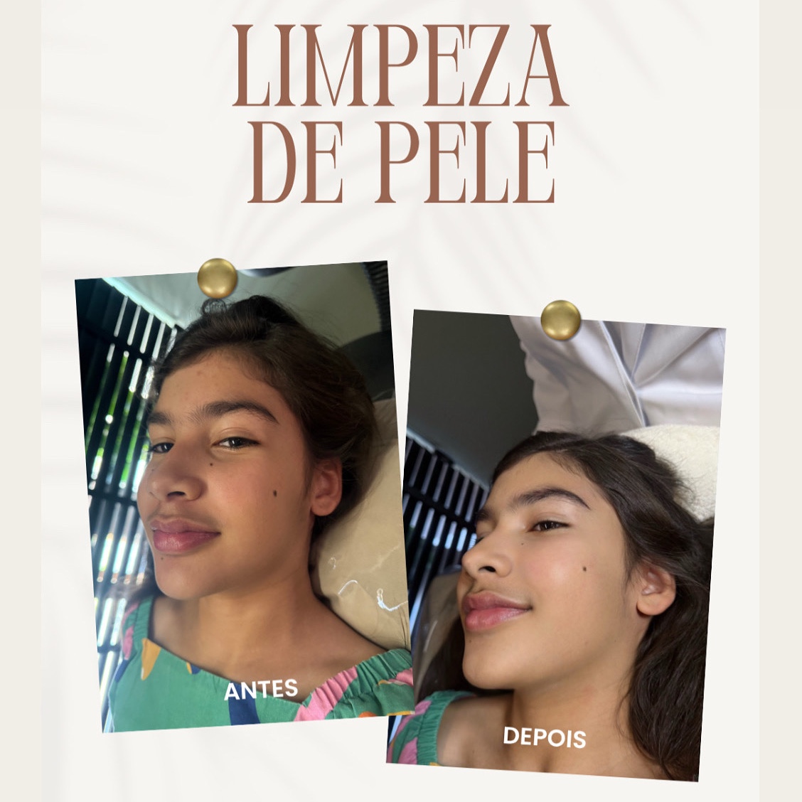 limpeza de pele + peeling de diamante