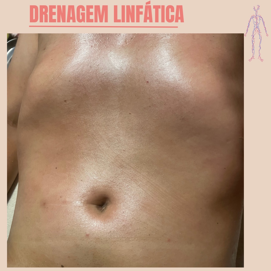 drenagem linfática completa
