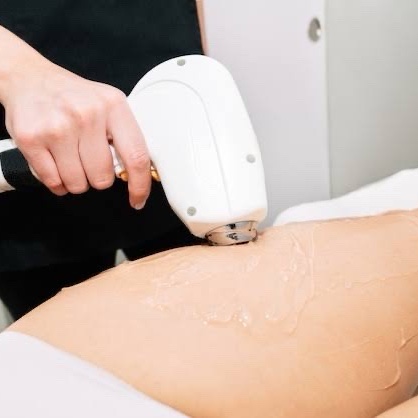 depilação a laser PACOTE COXA E VIRILHA