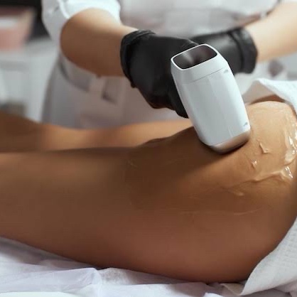 depilação a laser MEIA COXA OU PERNA