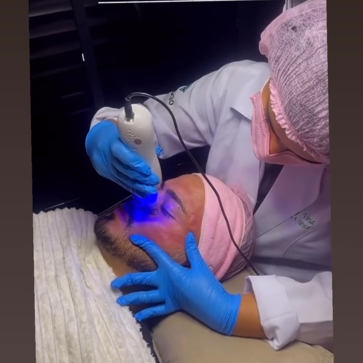 peeling de diamante