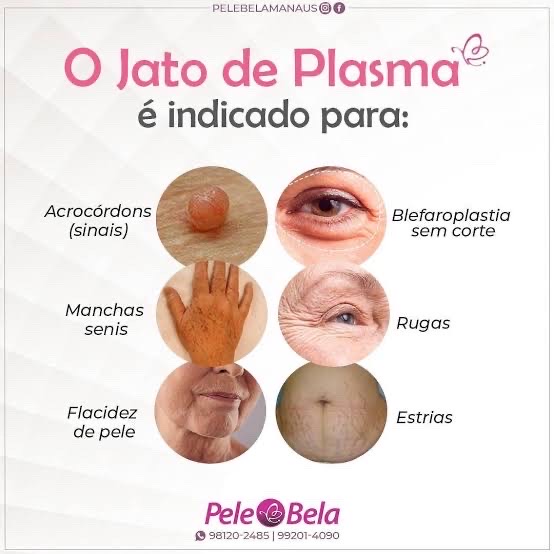 remoção de sinais
