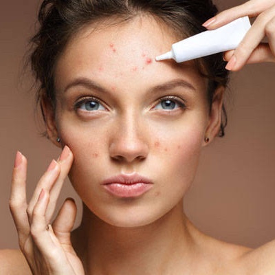 protocolo de acne