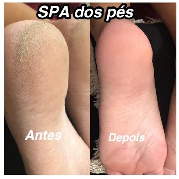 Spar dos Pés