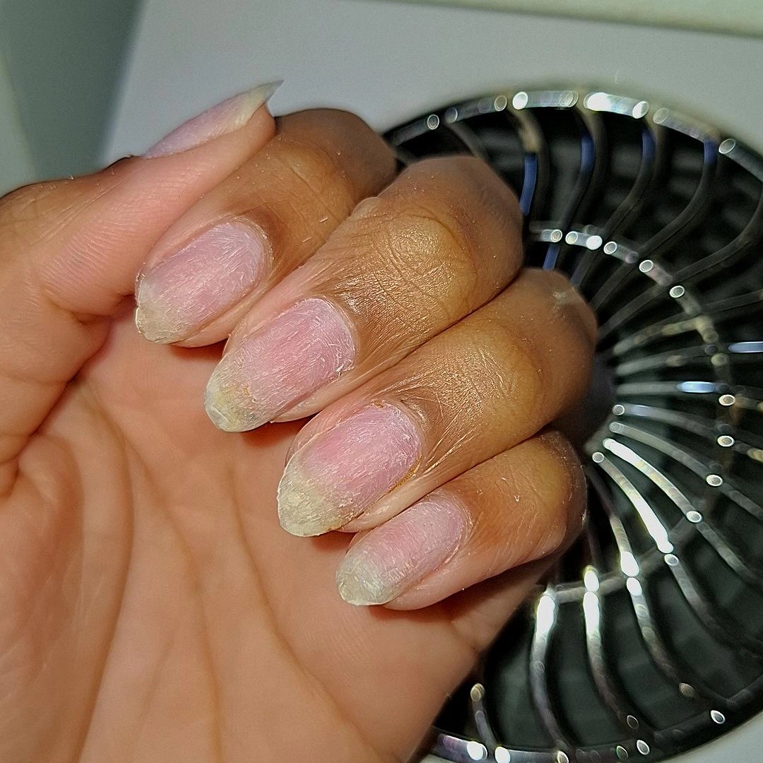 manutenção (gel)