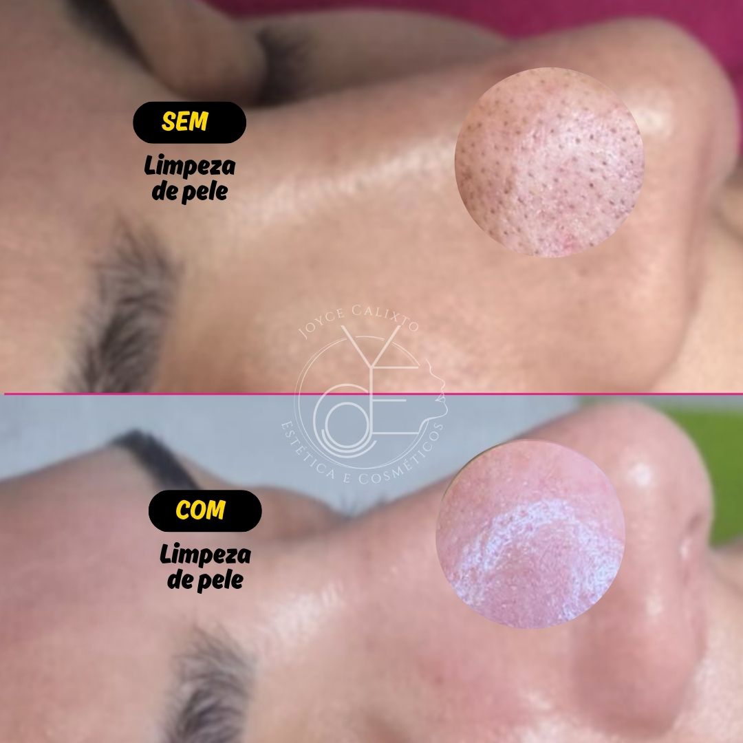 limpeza de pele, SPA dos pés e massagem relaxante