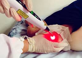 Laser Terapia