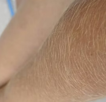Banho de Lua + Esfoliação Preparação da pele para um bronzeado uniforme, com clareamento de pelos e maciez.