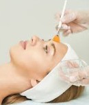 Retorno Peeling