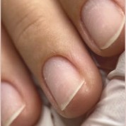 Limpeza das unhas