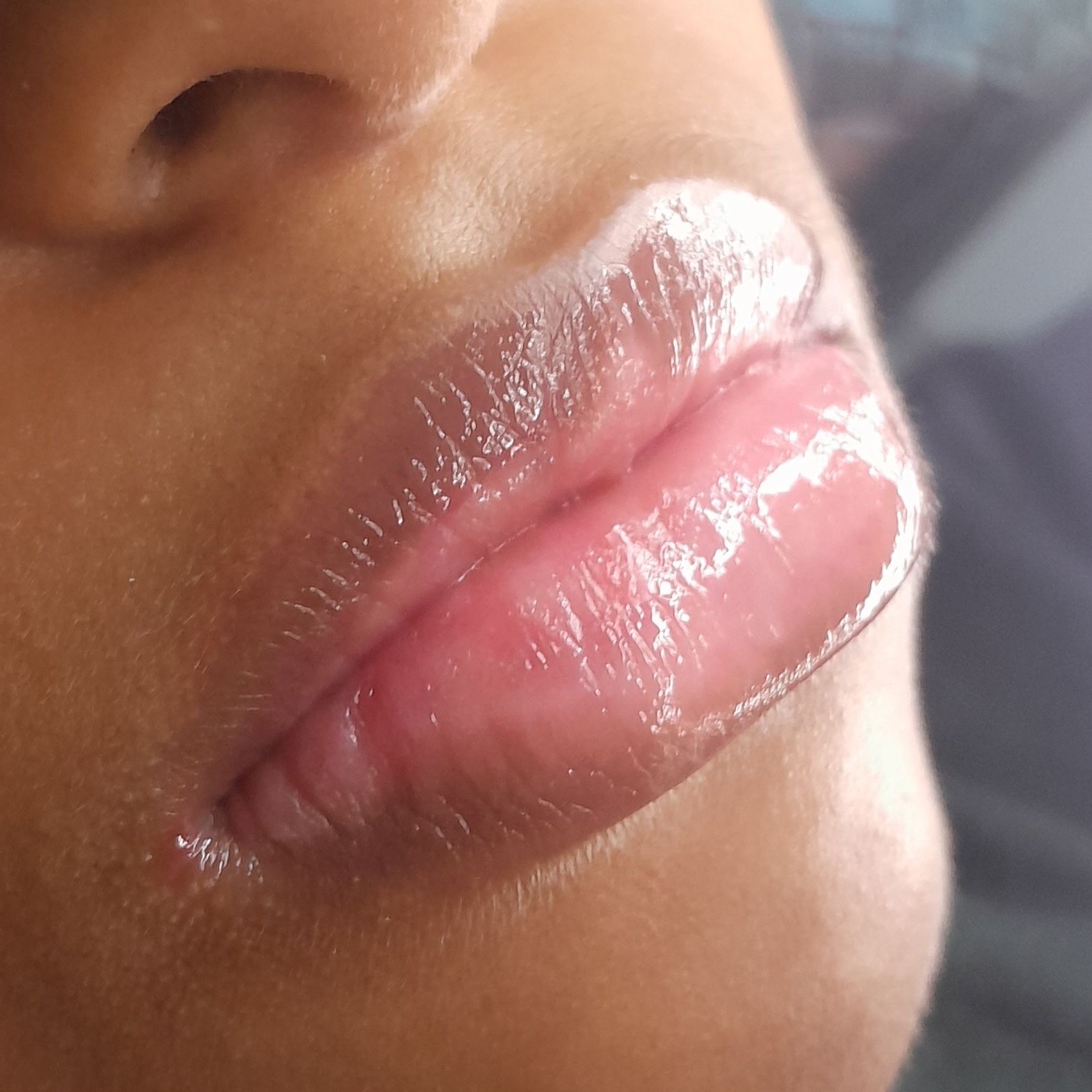 spa labial