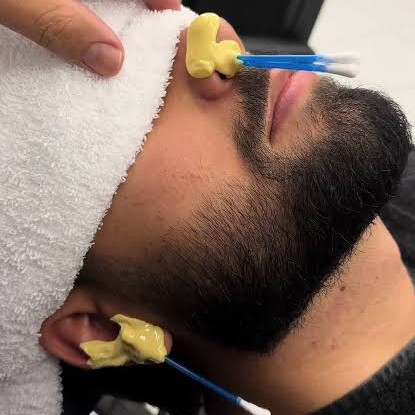 LIMPEZA NARIZ/ORELHA CERA QUENTE