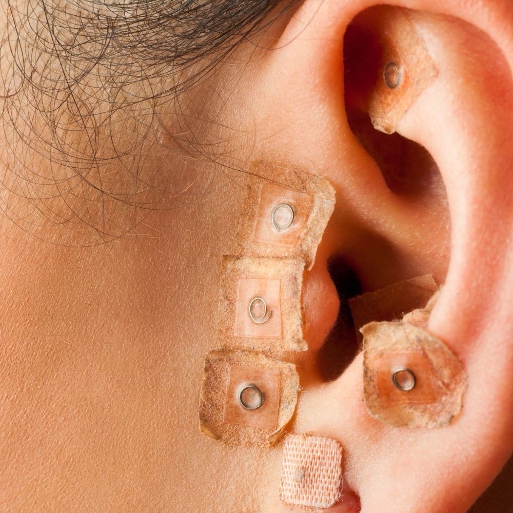 Auriculoterapia – Equilíbrio e Bem-Estar