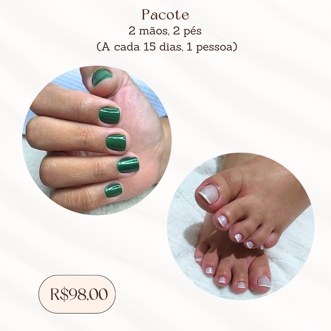 Pacote (2 mãos e 2 pés)