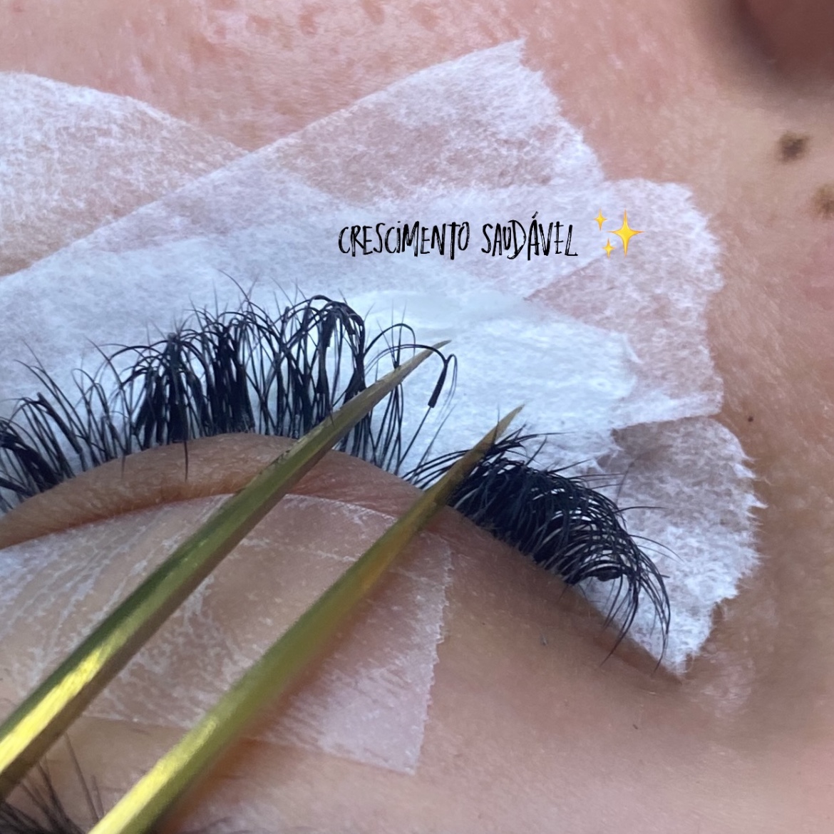 manutenção de 15 a 21 Dias Apois é remoção e nova aplicação