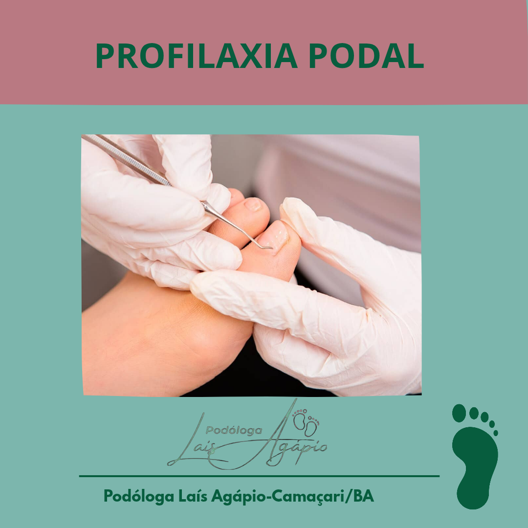 PODOPROFILAXIA - Podologia em Camaçari -BA