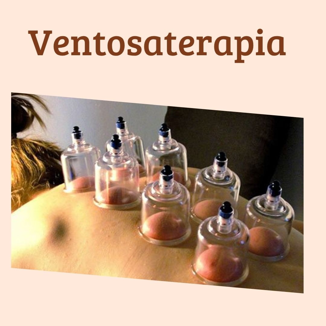 Ventosaterapia