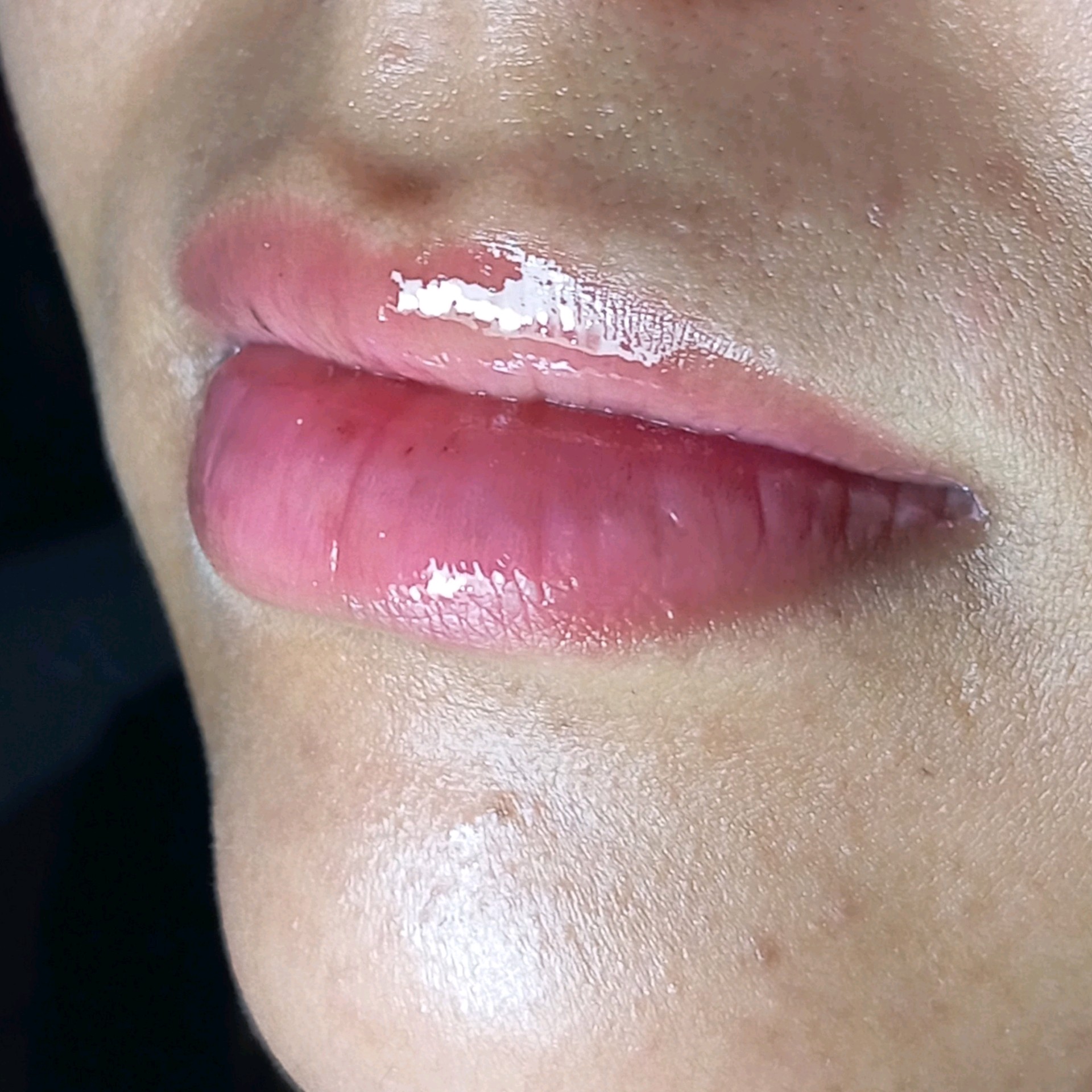 Depilação de buço