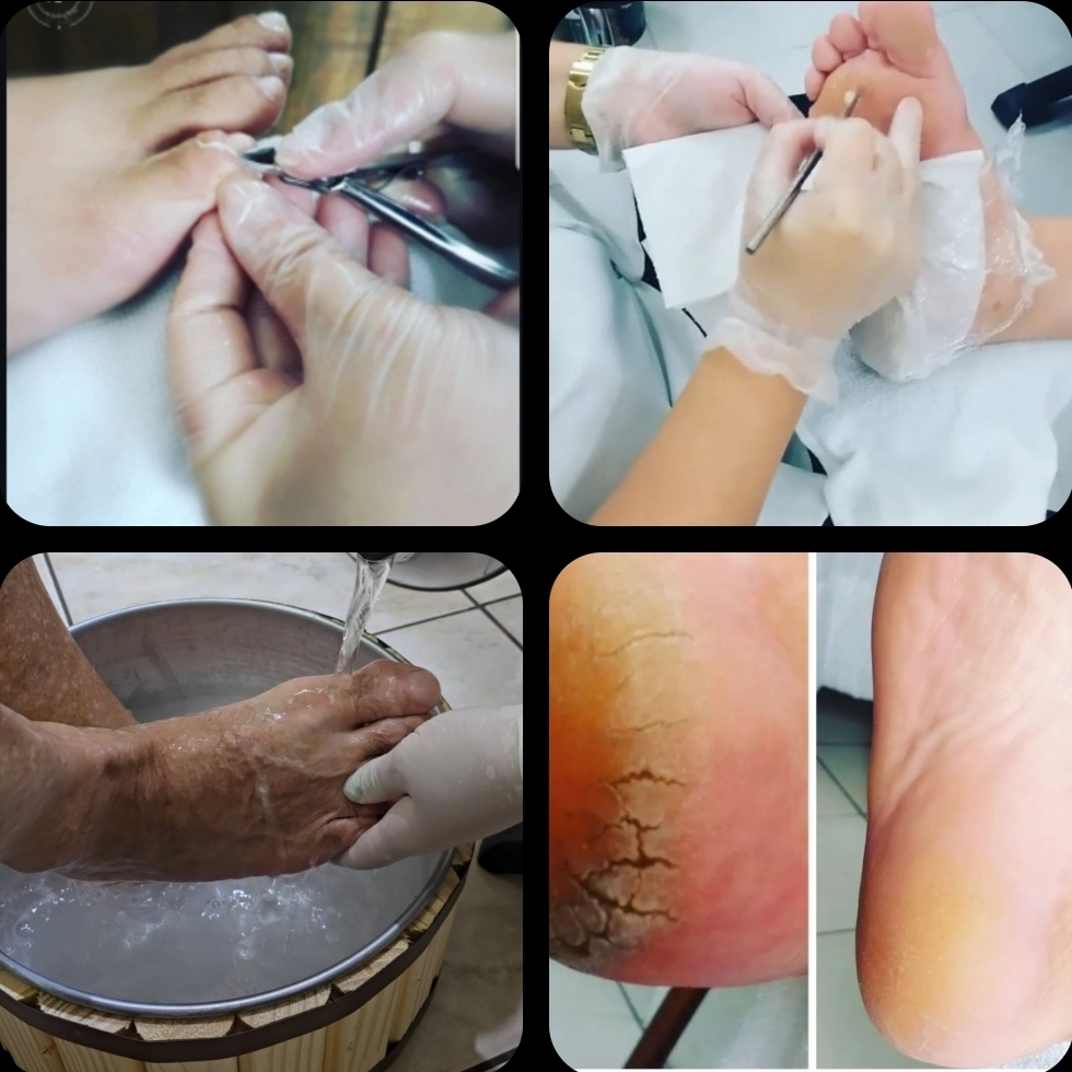 Spa Remoção +,Terapêutico