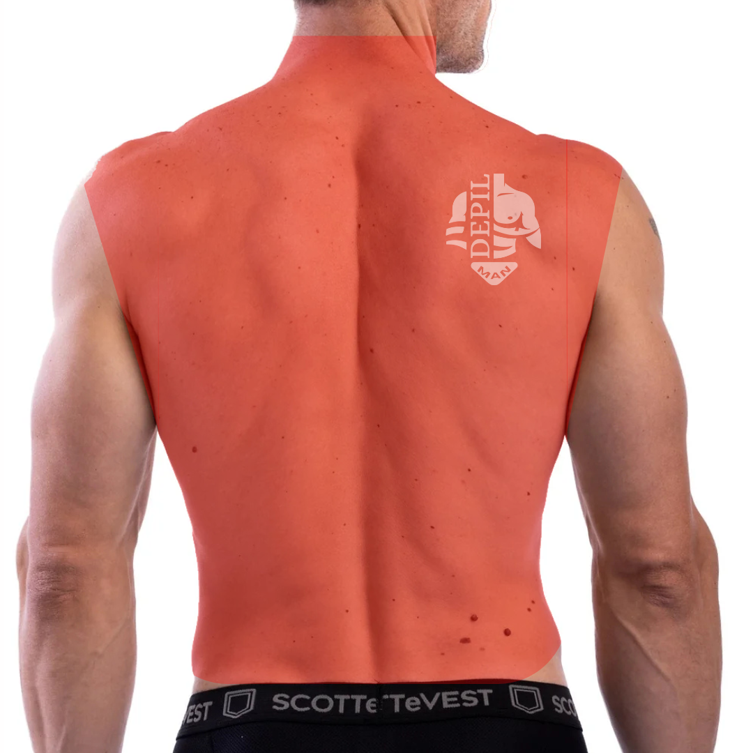 Dep Masc – Costas Totais (G)