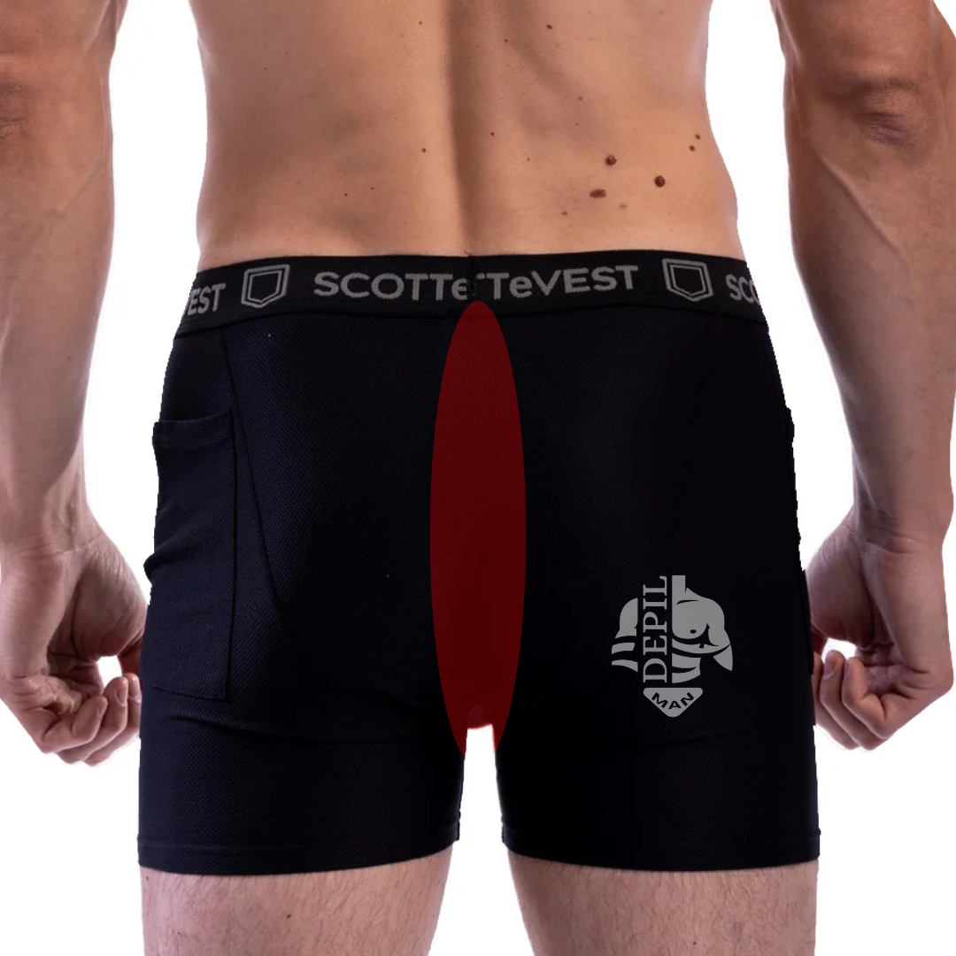 Dep Masc – Ânus (P)